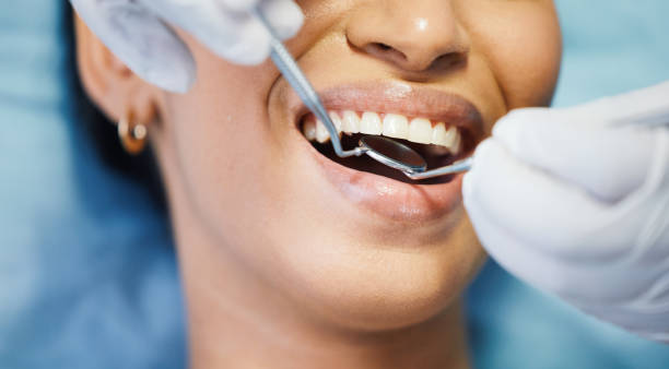 Best Broken or Chipped Tooth Repair in Elmira Heights, NY